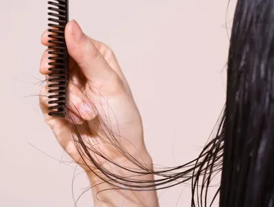 Лечение Выпадения Волос и Причины | Asthetiklab