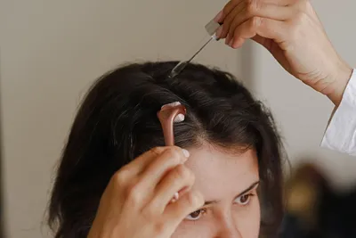 Выпадение волос: причины выпадения волос и что делать в таком случае?