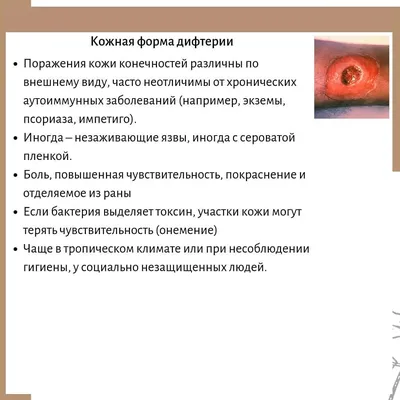 Предупреждение врачей: корь - это еще не все, могут вернуться и более  опасные болезни - Delfi RU