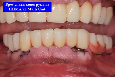 Особенности синтеризации диоксида циркония