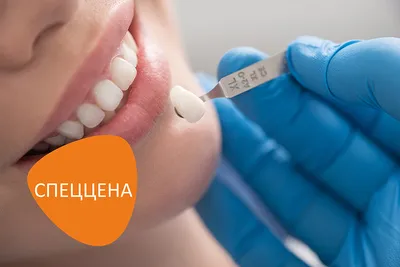 Диоксид циркония: критика и факты - DENTALMAGAZINE.RU