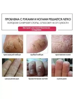 Процедура Hydrafacial - чистка лица - ЦИДК