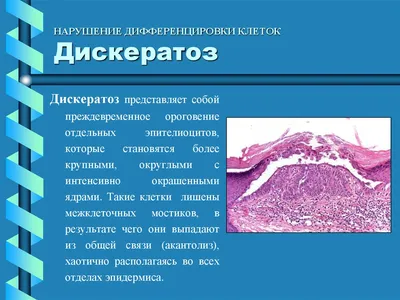 Gladkaya roskosh - Довольно частые проблемы – сухость и ороговение кожи  пяток, появление трещин или потертостей. ⠀ Значительно улучшить состояние  стоп позволят ежедневные ножные ванночки 🛀. Они не только очищают кожу, но