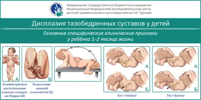 Дисплазия тазобедренных суставов у детей - передовые методы диагностики и  лечения