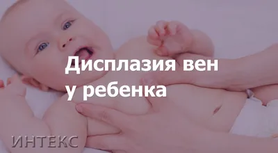 Как определить дисплазию тазобедренного сустава у ребенка? - IdealMed