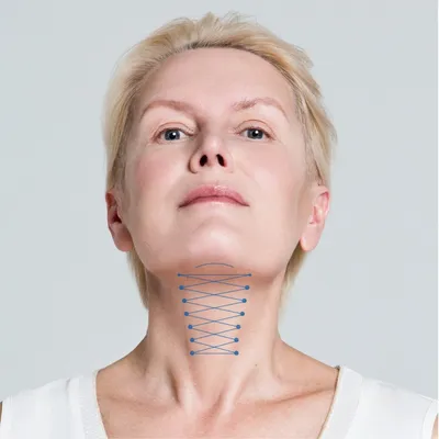 Ботокс в шею: эффективное омоложение без хирургии