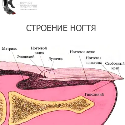 Протезирование ногтей на ногах, восстановление ногтевой пластины ✓ Клиника  подологии Полёт в Москве