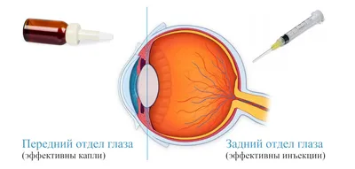 Лазерное лечение заболеваний глаз в Волгограде от 6000 руб | Хирургия Глаза