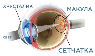 Дистрофия сетчатки, лечение дистрофии сетчатки глаза в клинике УникаМед |  Клиника УникаМед - уникальные технологии лечения