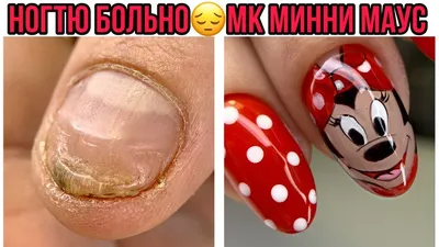 Микки Маус на ногтях (видео уроки дизайна ногтей) - YouTube