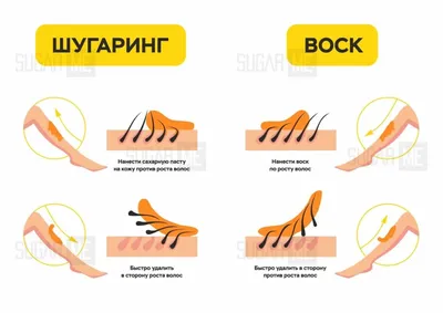 Оптимальная длина волосков для шугаринга | SugarMe