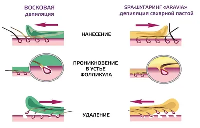 Как сделать шугаринг самой в домашних условиях: пошаговая инструкция для  зоны бикини, подмышек, ног