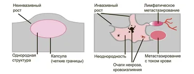 Удаление доброкачественных новообразований кожи - цена в Минске