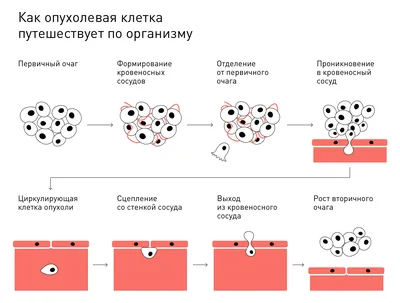 Ala Atlantis - Здравствуйте, сегодня расскажем о видах новообразований кожи.  Новообразования кожи – доброкачественные или злокачественные опухолевые  поражения кожи в результате патологического разрастания клеток тканей. К  доброкачественным ...