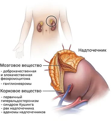 Онко Вики — Формы плоскоклеточного рака кожи