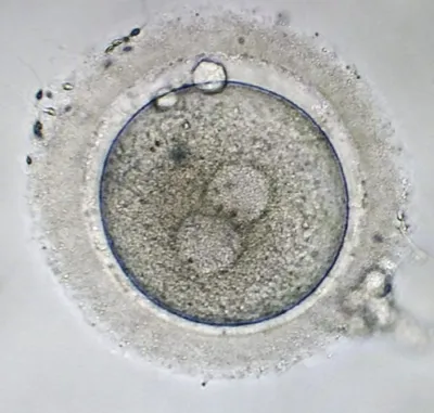 Требуются доноры яйцеклеток - новости клиники «Мать и дитя»