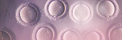 Оводонация: беременность с донорские яйцеклетки - Instituto Bernabeu