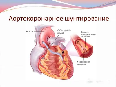 Vita Med - 😇 Всех у кого есть дополнительная хорда в сердце прошу поднять  руки в комментариях🙌 или просто ➕ чтобы успокоить взволнованных родителей  и мне статистики🌸 У моей Мари есть. На