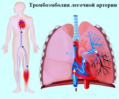 Эхокардиография ( УЗИ сердца). - «Важному органу - важное исследование. Дополнительная  хорда в сердце, сеть Хиари: чем опасны, требуют ли лечения, и к чему может  привести если оставить это без внимания. » | отзывы