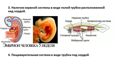 Трабекулы в сердце: что это, для чего нужны, история изучения