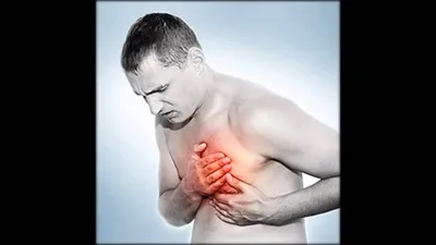 Приобретенные пороки сердца – диагностика и лечение в ФНКЦ ФМБА России