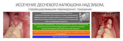 Гнойник на десне (абсцесс десны, зуба) – что делать, виды, методы лечения