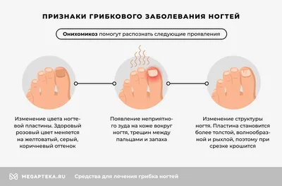 Грибок ногтей лечение на ногах, недорогие но эффективные средства