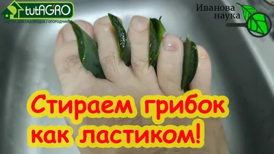 Грибок ногтей: как вовремя выявить и устранить проблему | Медлаб