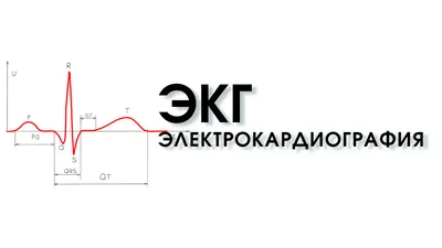 Экг С Инфаркт Миокарда И Пара Ventricular Premature Ударов — стоковые  фотографии и другие картинки Болезнь - iStock