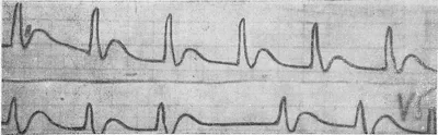 OMI-NOMI vs STEMI-NSTEMI. Время для смены парадигмы? | КлинКейсКвест