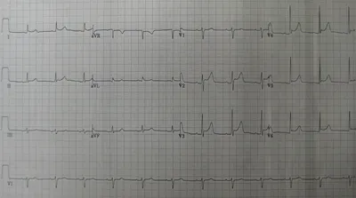 Электрокардиография (ЭКГ) в Ярославле | Константа LIFE [Клиника лечения  боли]