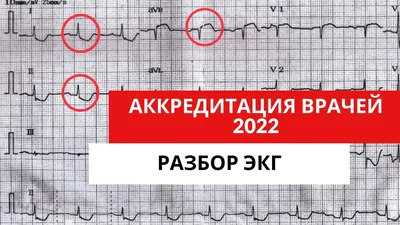 Инфаркт миокарда консультация лечение в Санкт-Петербурге в медицинском  центре ID-CLINIC