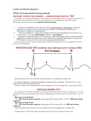 Инфаркт миокарда консультация лечение в Санкт-Петербурге в медицинском  центре ID-CLINIC