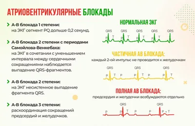 ЭКГ в Севастополе - цена, записаться на ЭКГ в МЦ Мята