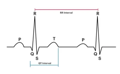 ЭКГ регистрация поворота сердца (ротация) | Пикабу