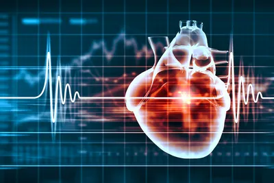 ЭКГ – диагностика состояния сердца. Показания к ЭКГ, что показывает  исследование. Как делают ЭКГ
