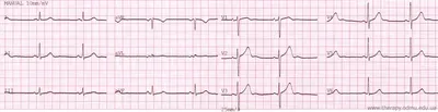 MedWeb - Что такое ЭКГ? | Медицинские цитаты, Холистическая медицина,  Учащиеся медучилища