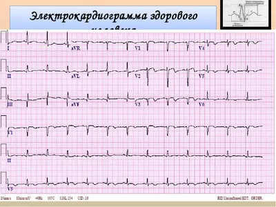 В пятницу 29 сентября с 12:00 до 18:00 в ДК им. Конина пройдёт акция,  посвящённая Всемирному дню здорового сердца / Новости / Официальный сайт  городского округа Егорьевск