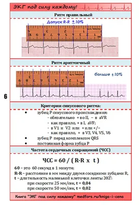 МРТ УЗИ «Сфера-СМ» Пушкино, Ивантеевка, Королёв - Здравствуйте уважаемые  читатели. Продолжаем информировать вас по тем здоровья сердца. На очереди  ЭКГ. . . ❤️ЭЛЕКТРОКАРДИОГРАММА . Давайте разберём подробнее, что же такое  кардиограмма. .
