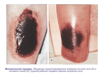 Проблемы кожи у детей – почему возникают сыпи, мокнутия, шершавость и  прочие проблемы | О детском здоровье: с врачебного на родительский | Дзен