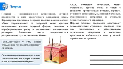 Псориаз: симптомы, виды болезни, лечение