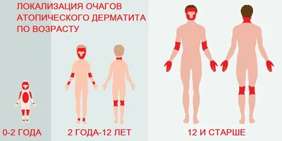 Дерматологические проявления вирусных инфекций. Часть 2