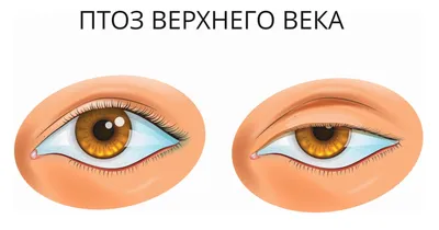 Что такое розацеа кожи: причины, симптомы, классификация, как лечить |  Лазерсвiт