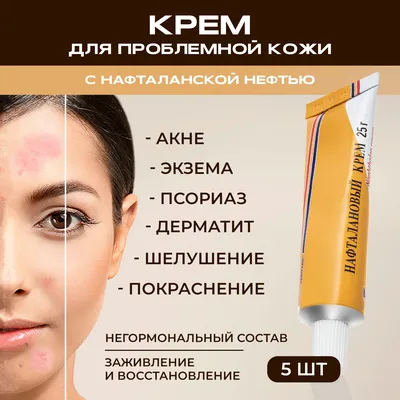 Опухли веки - причины и лечение