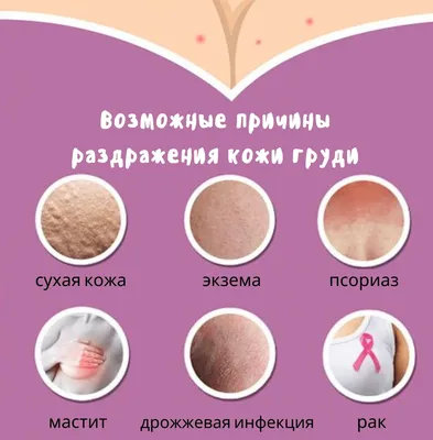 Я Косметолог - Розацеа - это хроническое воспалительное заболевание кожи  лица, характерное частыми рецидивами. Чаще всего розацеа встречается у  женщин в возрасте 30 - 50 лет. Мужчины подвергаются этому заболеванию в  два-три