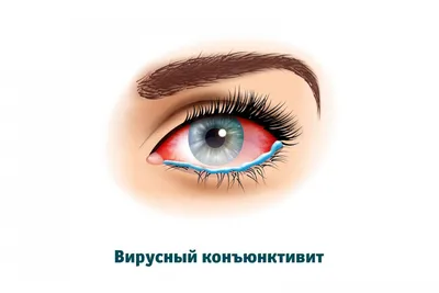 Периорбитальный дерматит: 9 фото, причины, симптомы, лечение, профилактика  – Лостерин