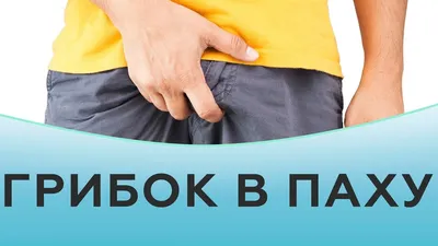 Что такое невусы (родинки) и их разновидности - Лазерсвiт