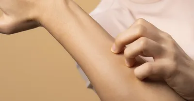Нос до и после ринопластики (безоперационной)