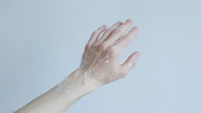 Псориаз экзема крем мазь от экземы на руках мазь для кожи дерматита  китайские травы медицинский уход за кожей | AliExpress