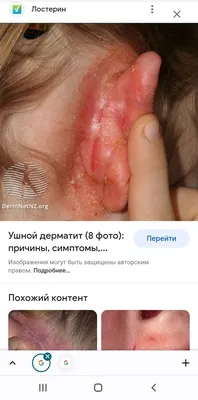 Опасны ли серные пробки?